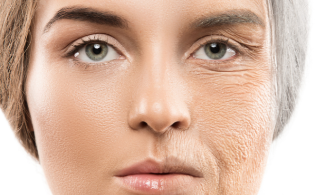 How to Treat Werner Syndrome?