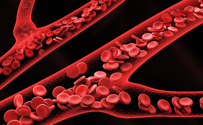 How to Treat Diamond Blackfan Anemia?