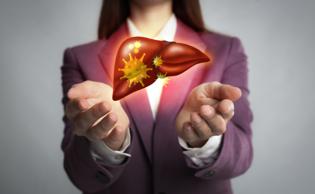 How to Treat Non Alcoholic Fatty Liver Disease?