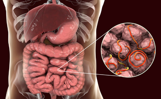 How to Treat Amoebiasis?