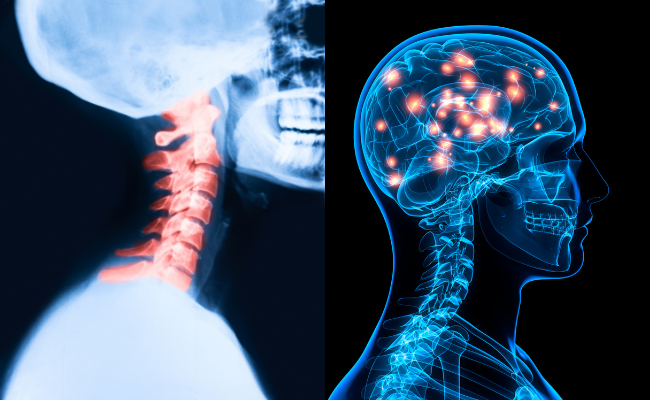 How to Treat Chordoma?