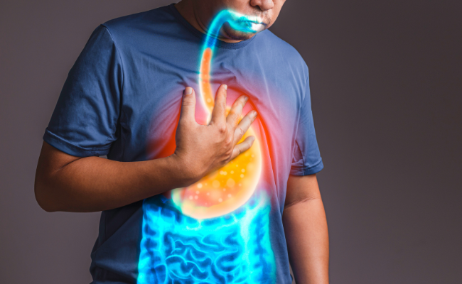 How to Treat Gastro Eesophageal Reflux Disease?