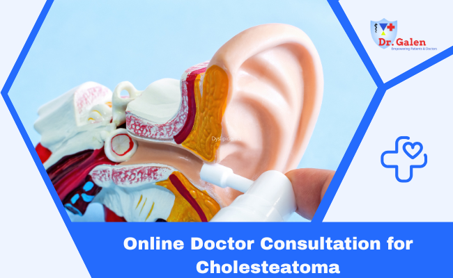 Online Doctor Consultation for Cholesteatoma