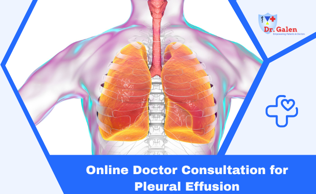 Online Doctor Consultation for Pleural Effusion