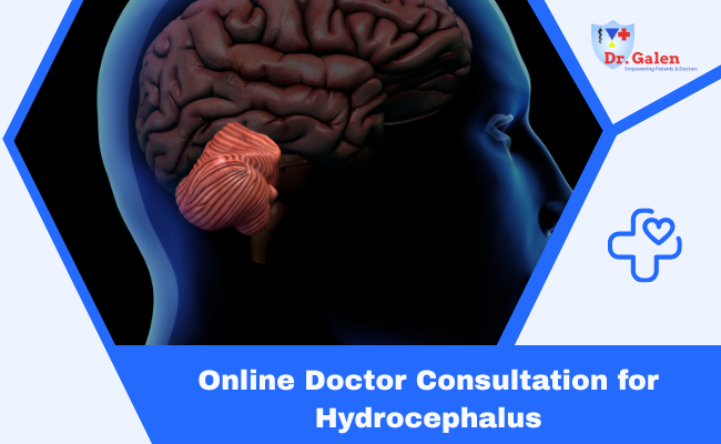 Online Doctor Consultation for Hydrocephalus