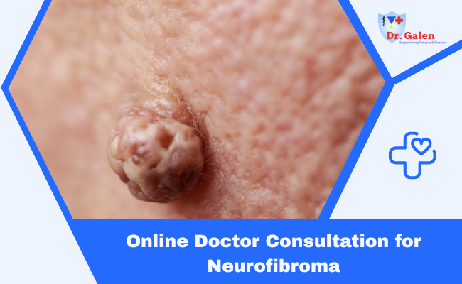 Online Doctor Consultation for Neurofibroma