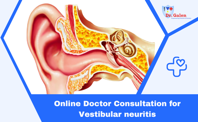 Online Doctor Consultation for Vestibular Neuritis