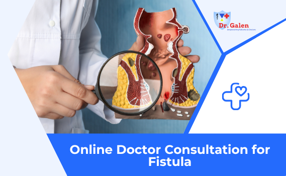 Online Doctor Consultation for Fistula